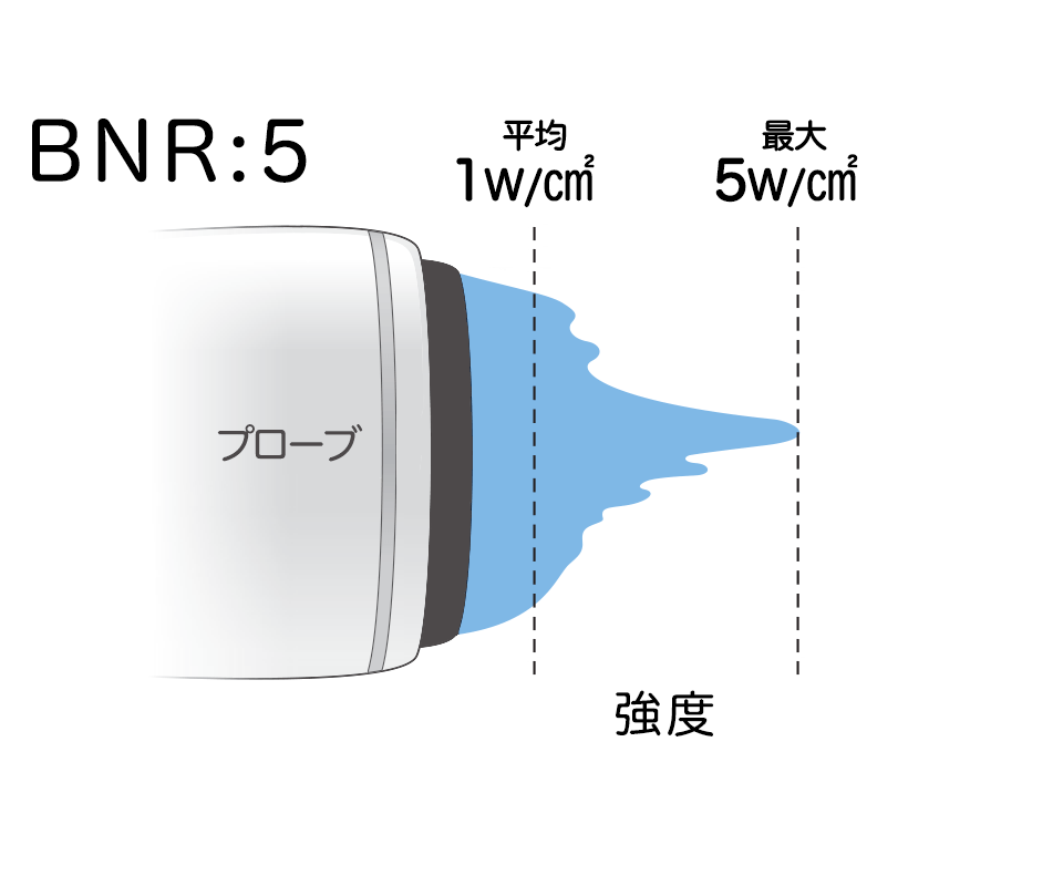 BNRが5の場合の超音波のイメージ