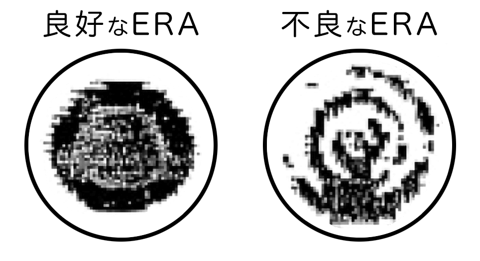 超音波機器のERAの比較